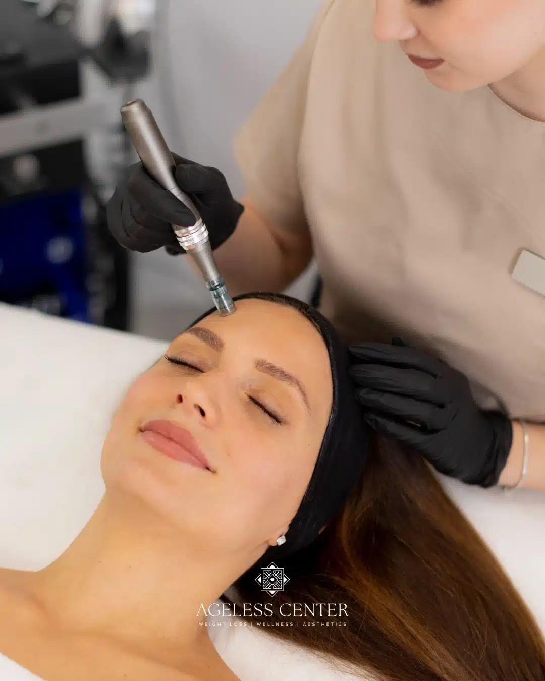 Microneedling Sessions You Need